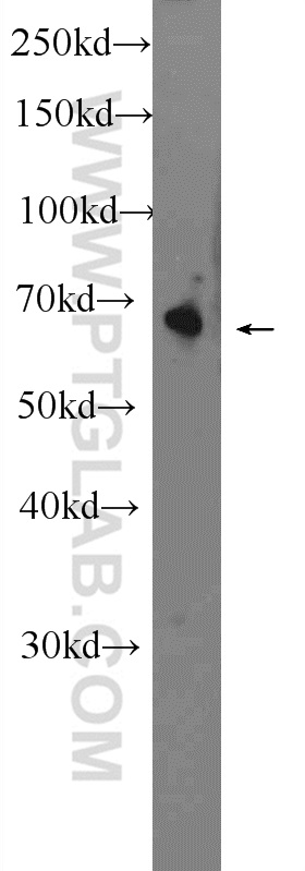 OTOP1 Polyclonal antibody