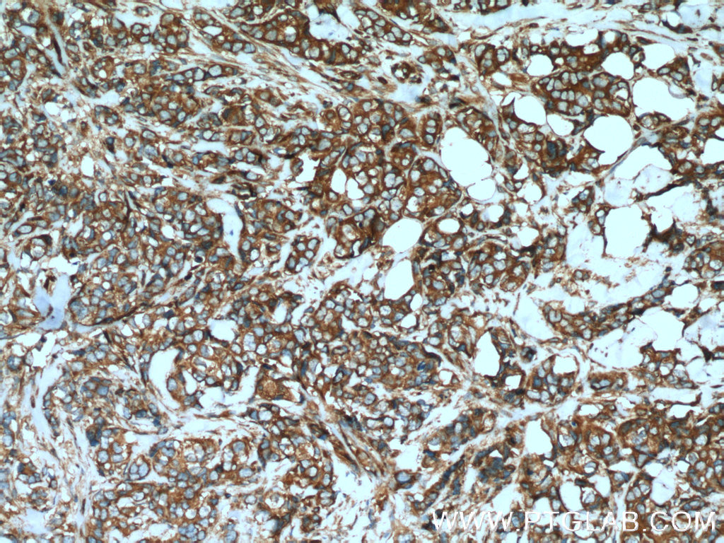 GEF-H1 Polyclonal antibody