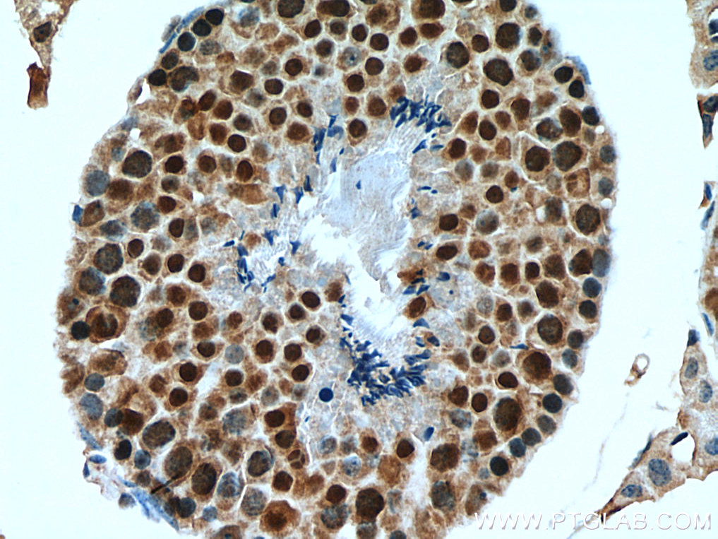 GID8 Polyclonal antibody