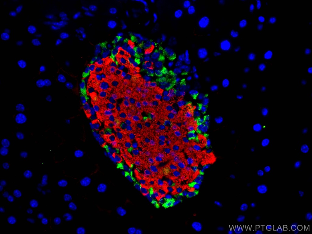 Somatostatin (1-116aa) Polyclonal antibody
