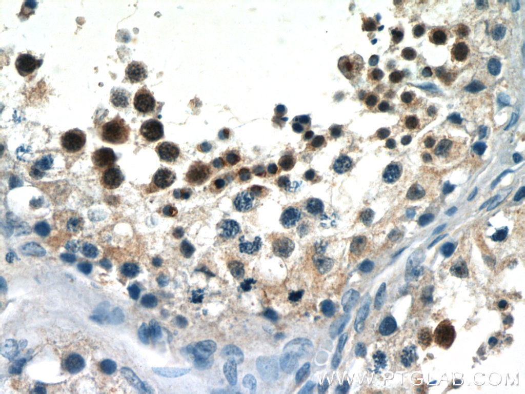SALL4 Polyclonal antibody