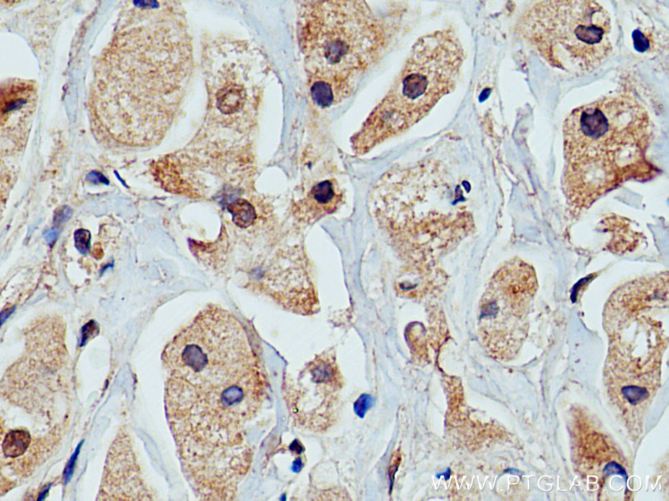 PRKACA Polyclonal antibody
