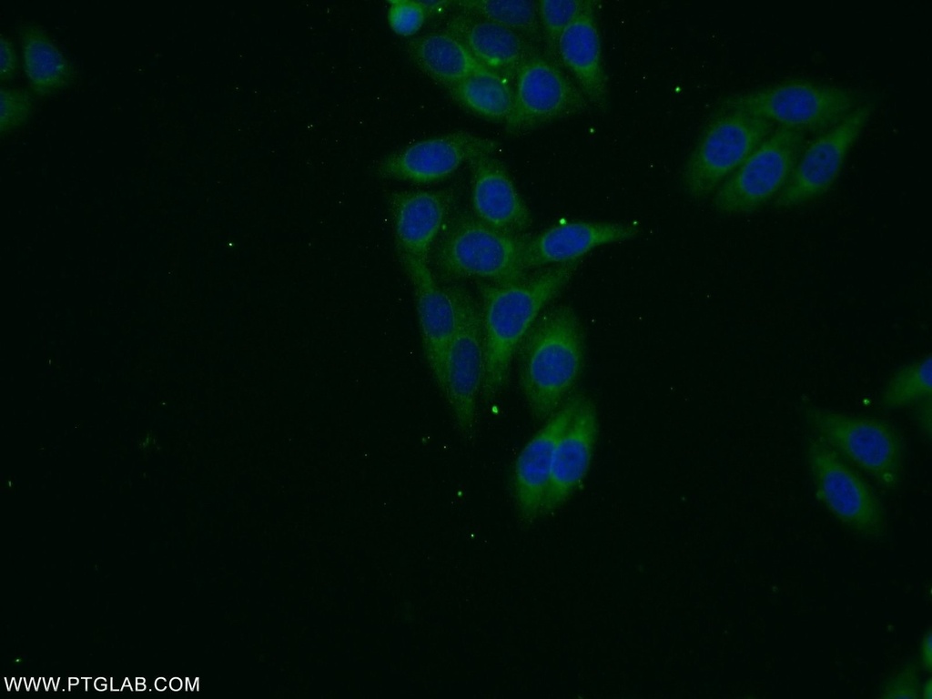 VPS13B Polyclonal antibody