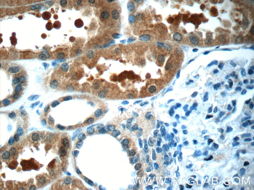 MAGIX Polyclonal antibody