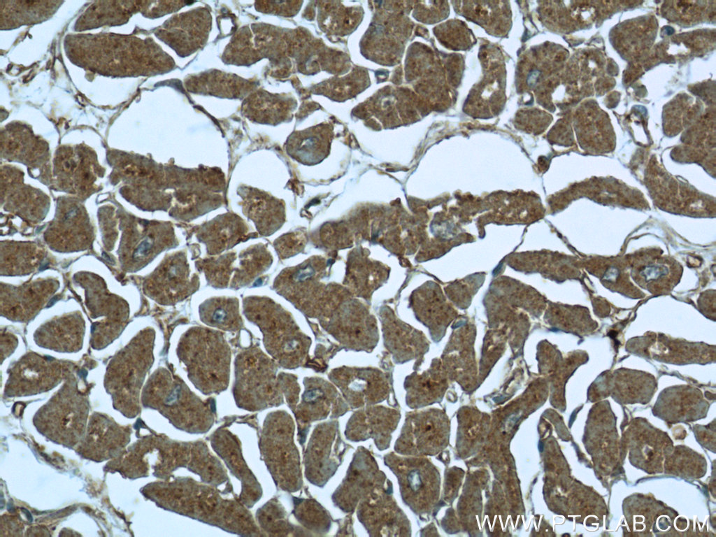 FBXO41 Polyclonal antibody