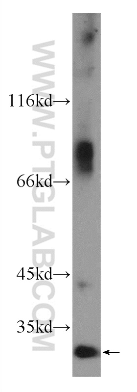 C16orf72 Polyclonal antibody