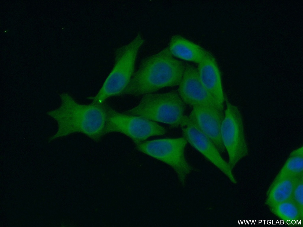 DHX57 Polyclonal antibody
