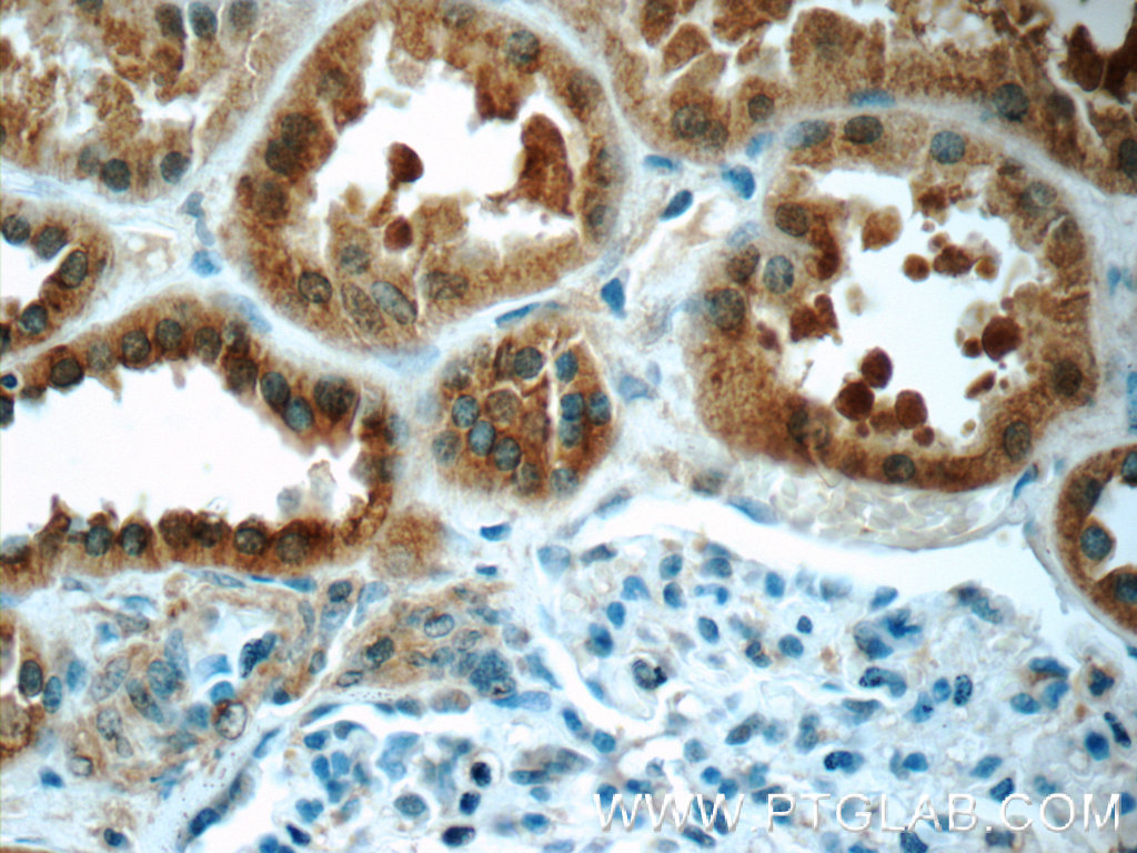 TMEM120B Polyclonal antibody