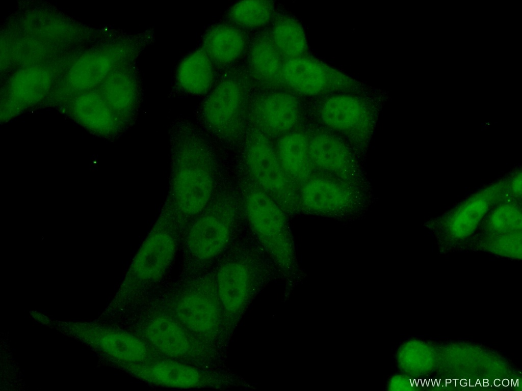 RPRD1B Polyclonal antibody