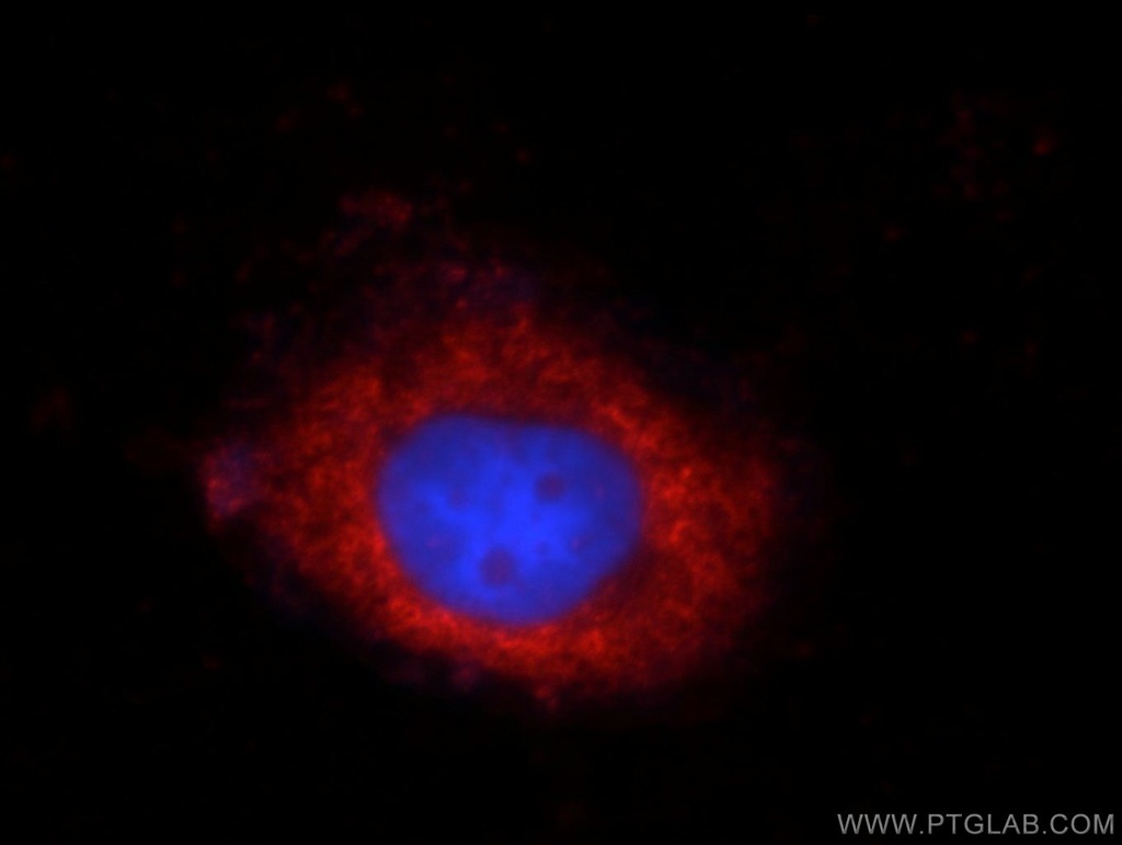 SHP1 Polyclonal antibody