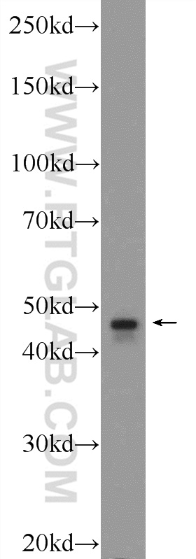 TBCEL Polyclonal antibody