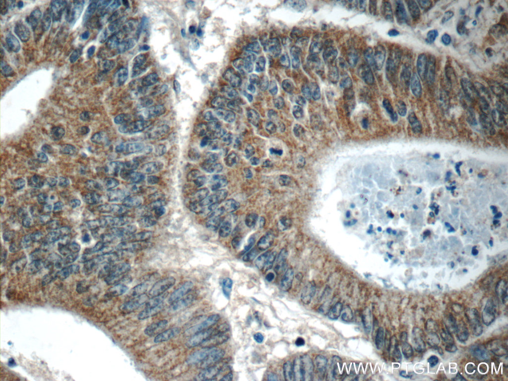 C8orf77 Polyclonal antibody