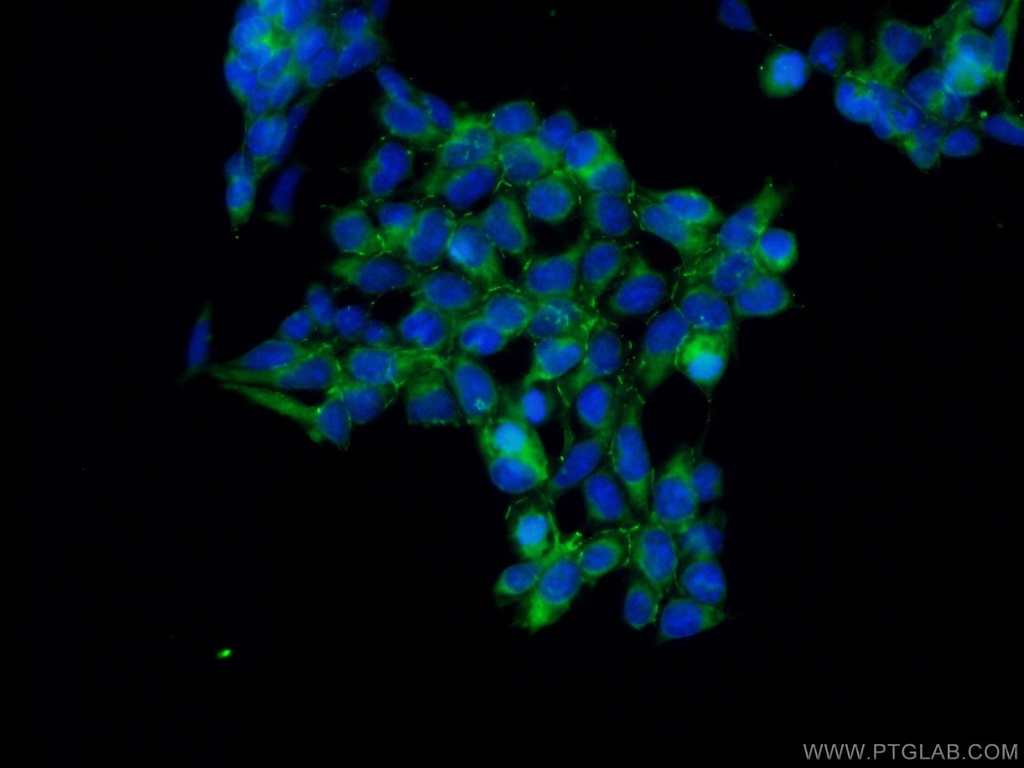AMOT Polyclonal antibody