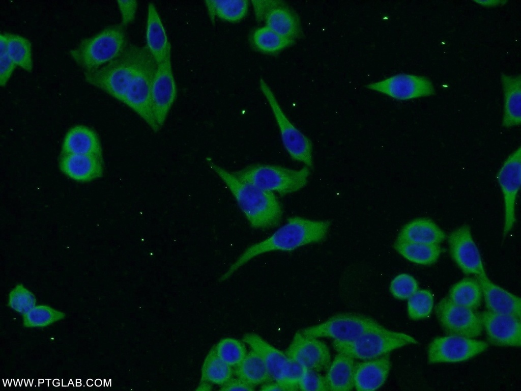 ENTPD7 Polyclonal antibody
