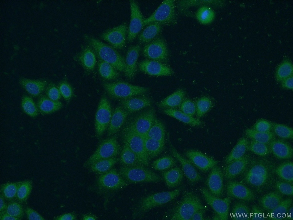 NCAPG Polyclonal antibody