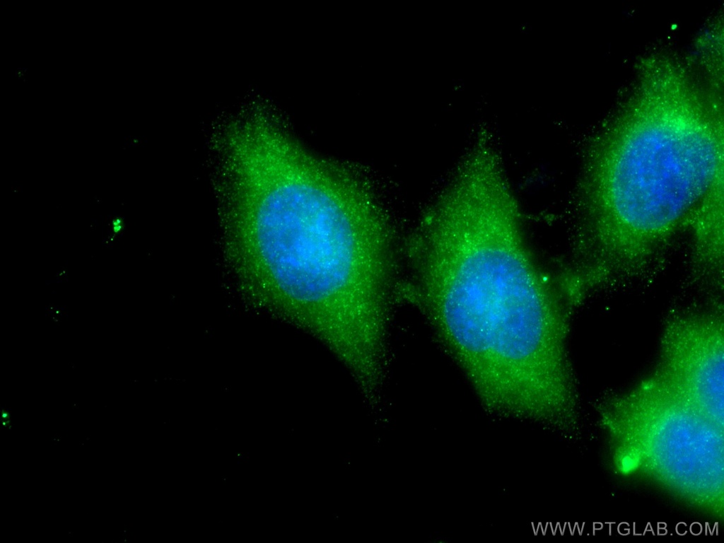 PCOTH Polyclonal antibody