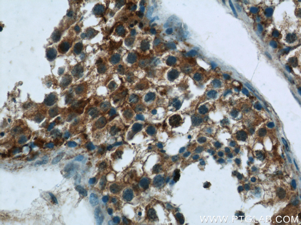 LRRC18 Polyclonal antibody