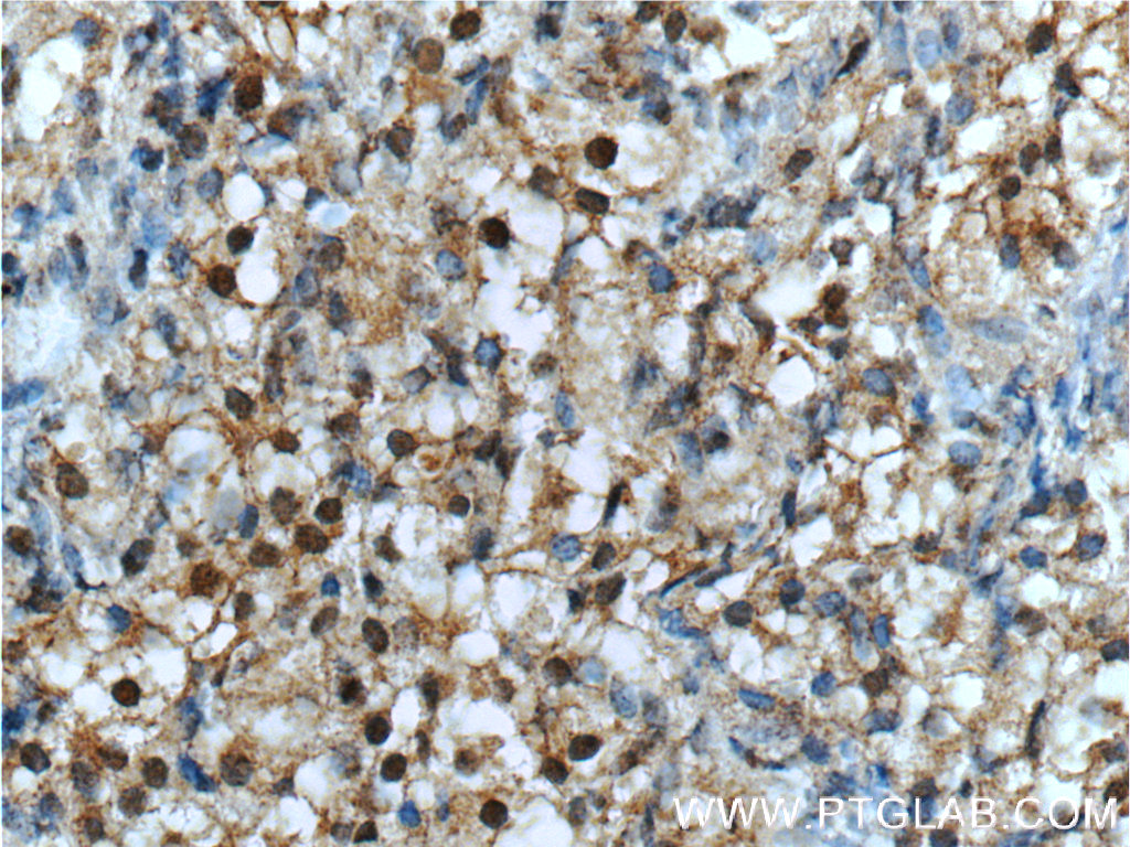NR2F1 Polyclonal antibody