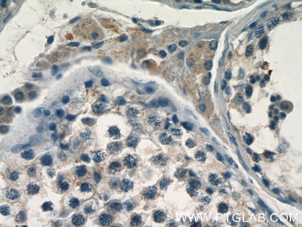 FAM133A Polyclonal antibody