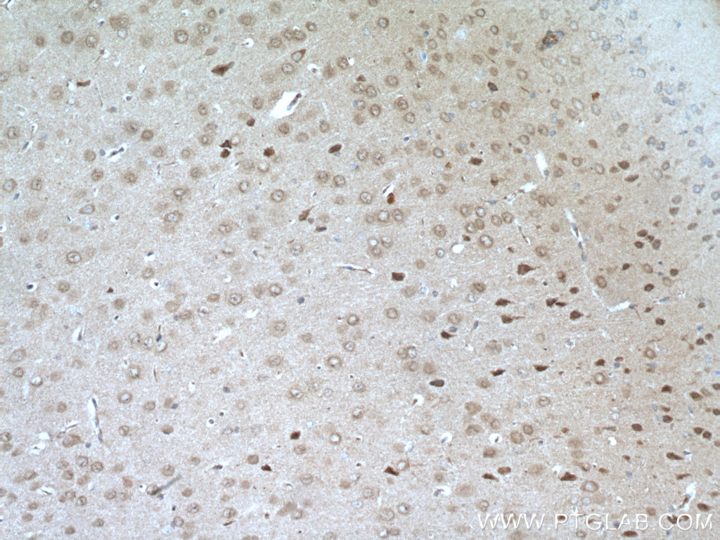 RIM1 Polyclonal antibody