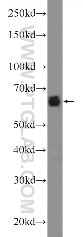 CCDC67 Polyclonal antibody