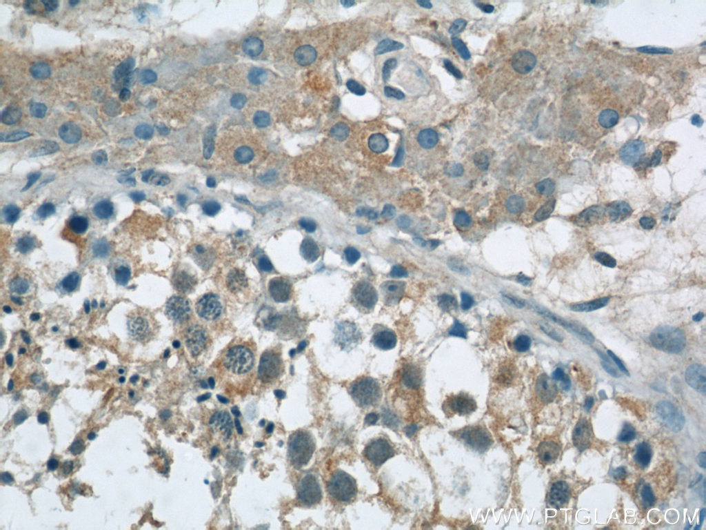 TEX15 Polyclonal antibody