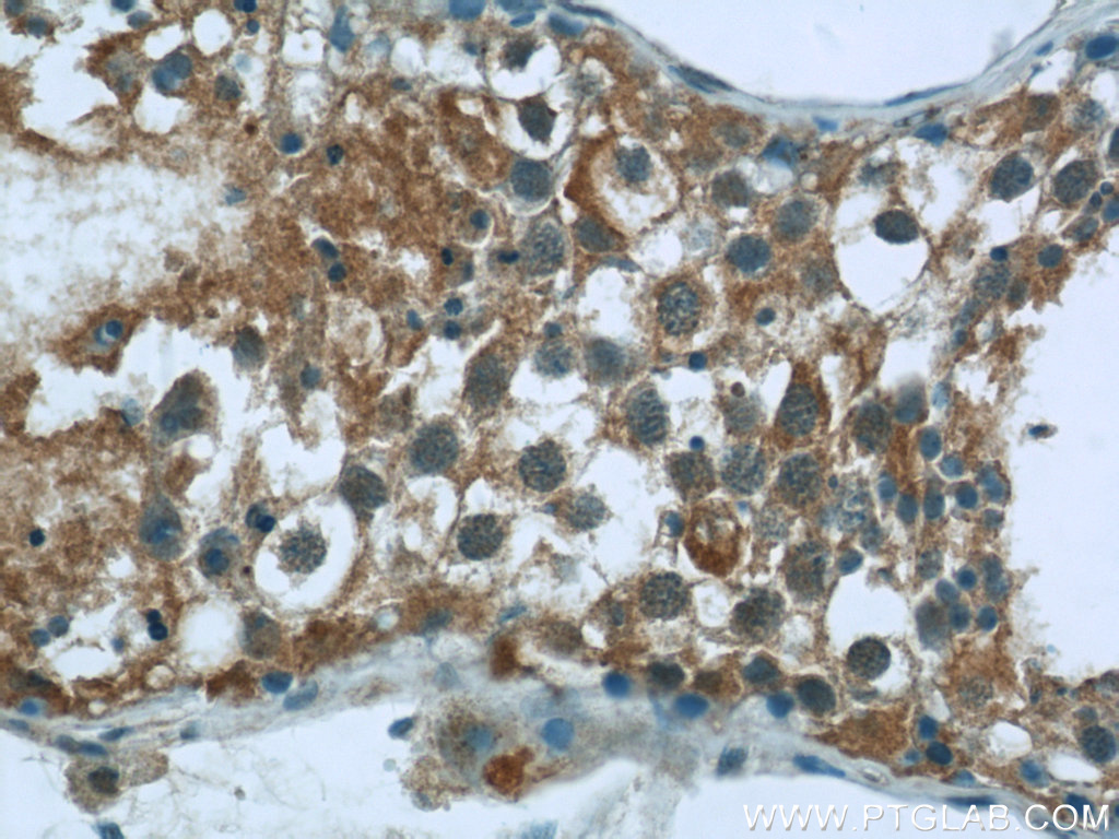 CEP85L Polyclonal antibody