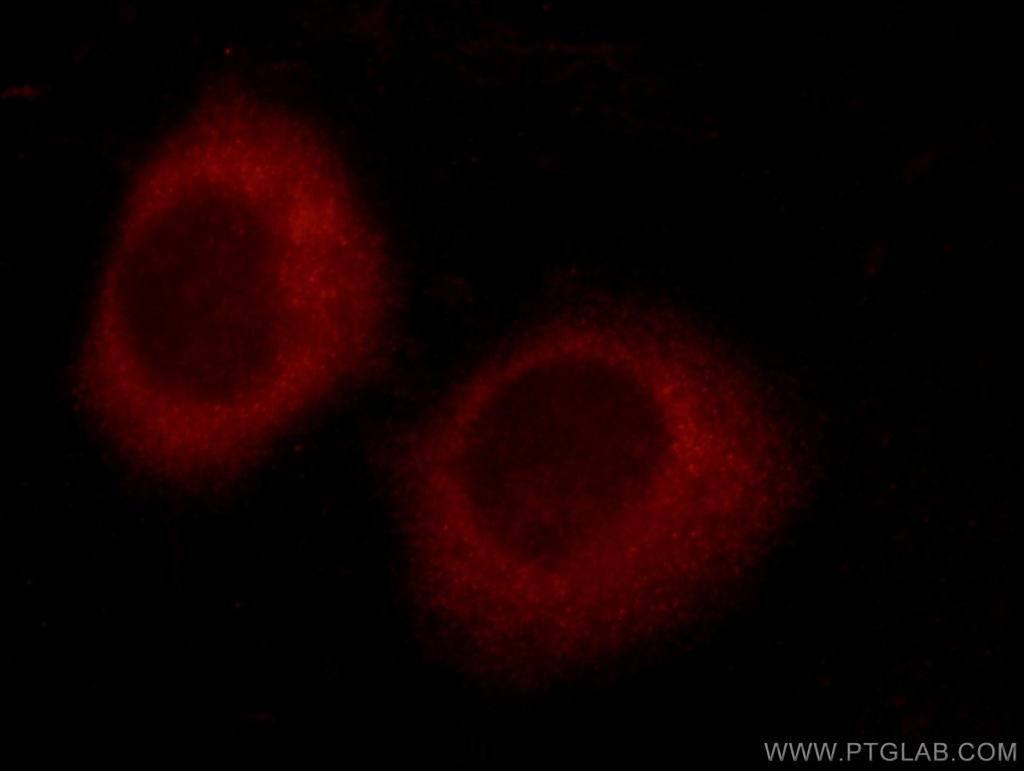 TTC37 Polyclonal antibody