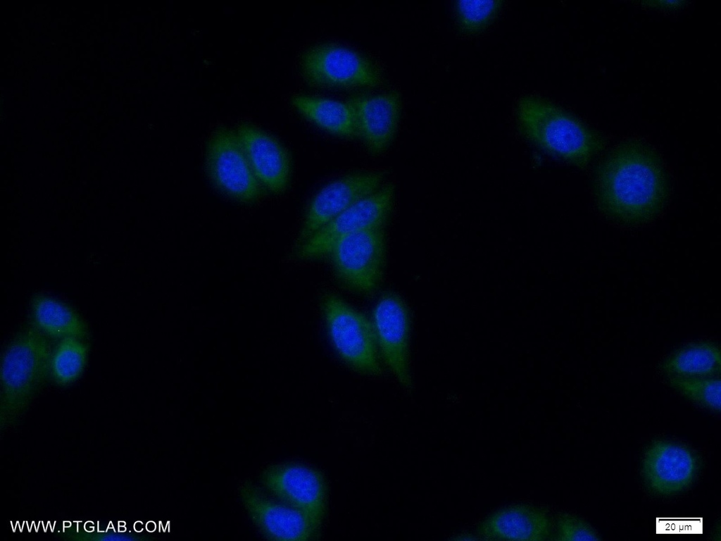 ZNF654 Polyclonal antibody