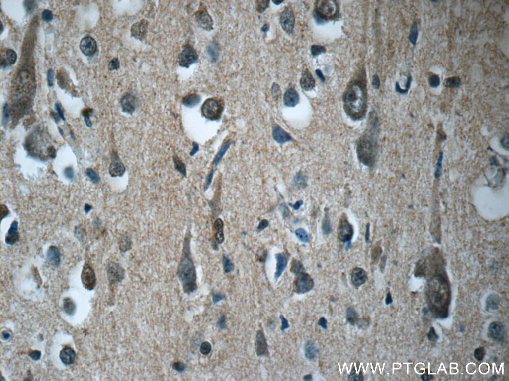 RAB3GAP2 Polyclonal antibody