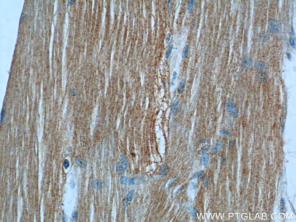 MBNL3 Polyclonal antibody