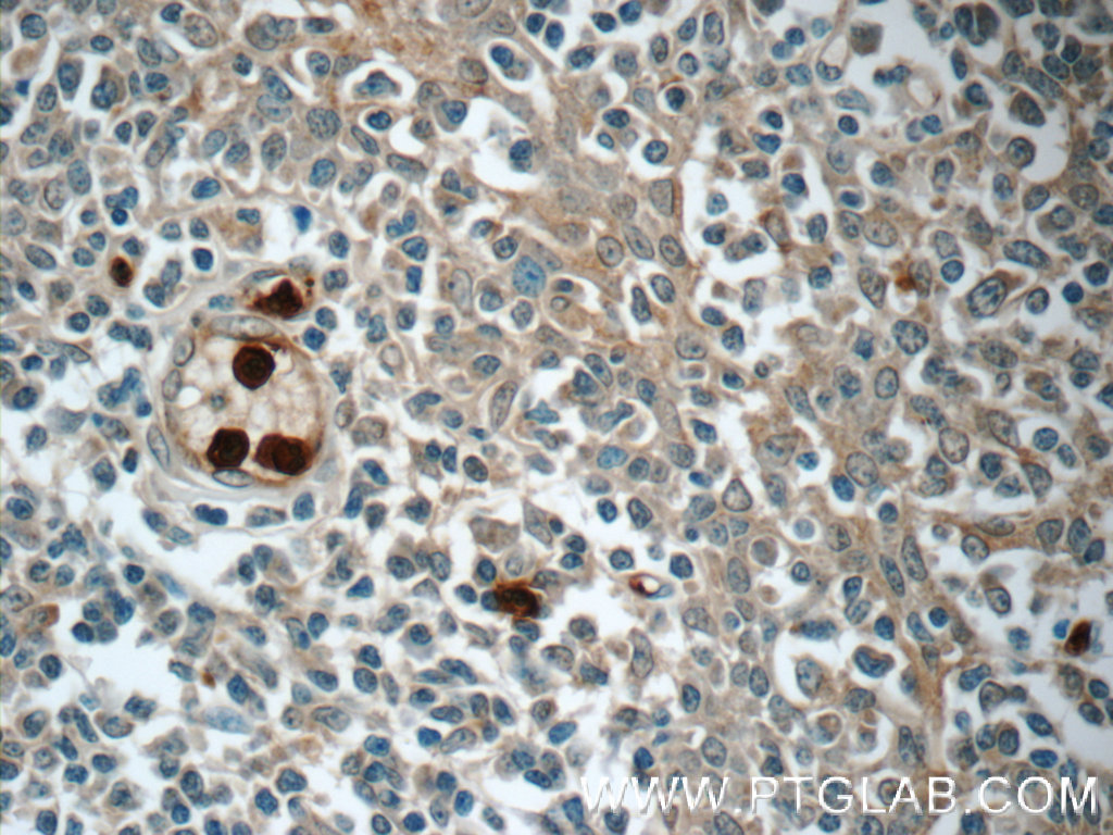 LY6G5B Polyclonal antibody
