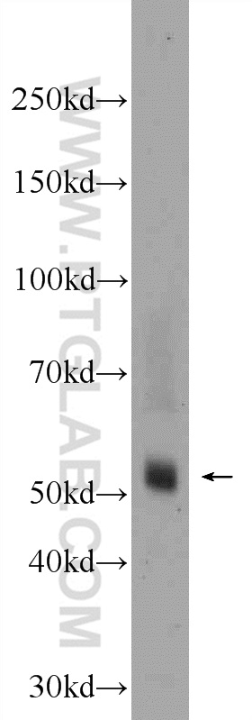 TMPRSS5 Polyclonal antibody