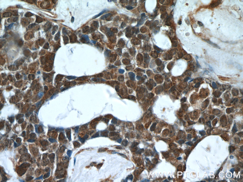PHF2 Polyclonal antibody