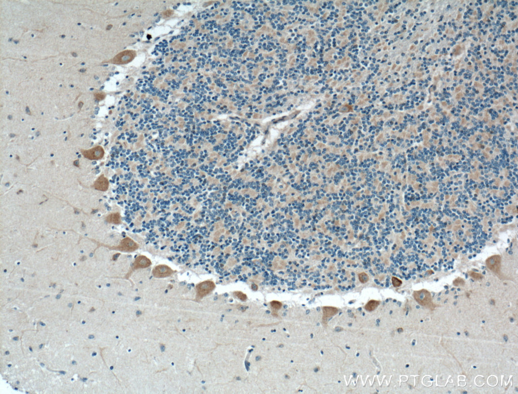 NPBWR1 Polyclonal antibody