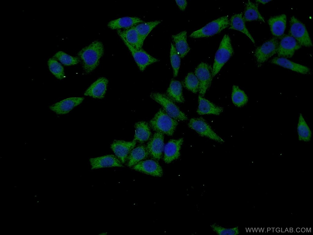 TARSL2 Polyclonal antibody