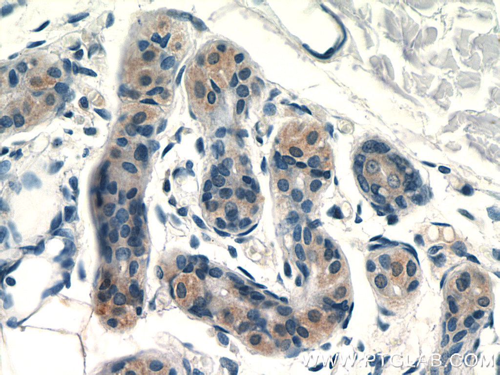 SPRR2F Polyclonal antibody