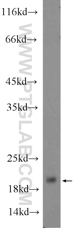 GKN2 Polyclonal antibody