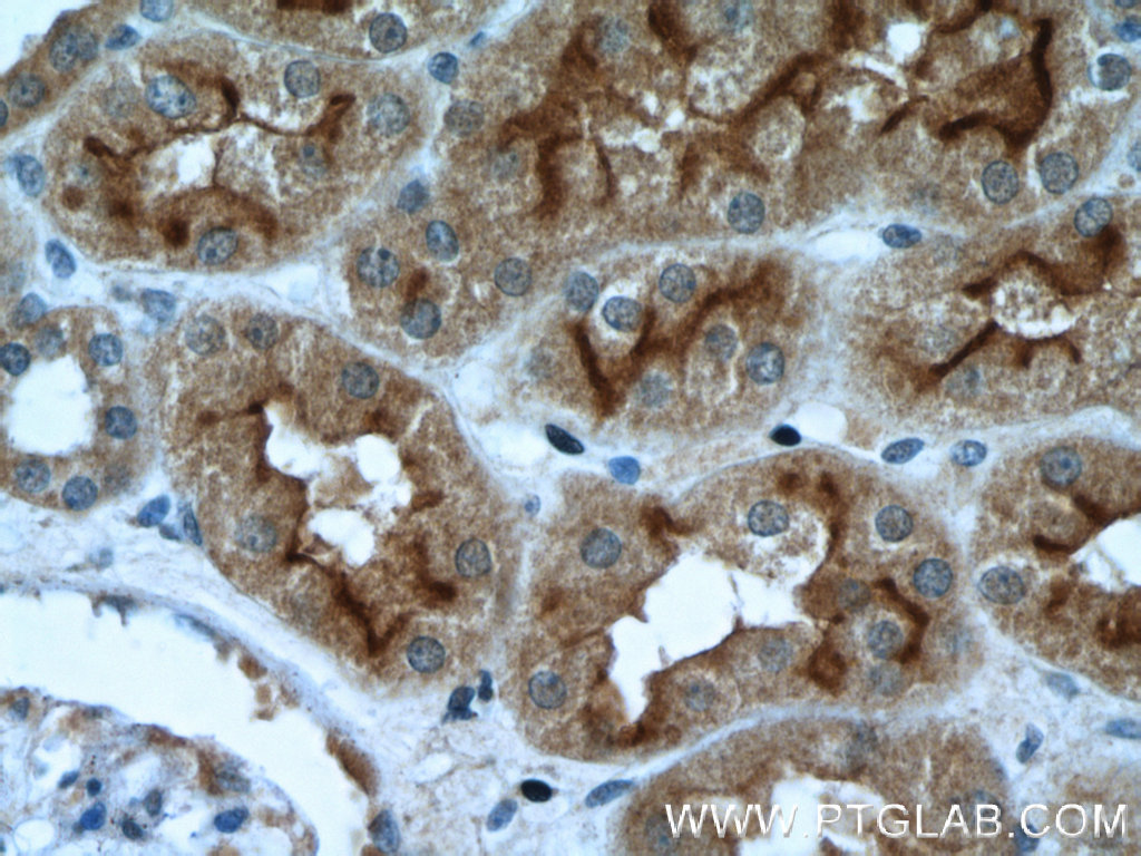 SGLT2 Polyclonal antibody