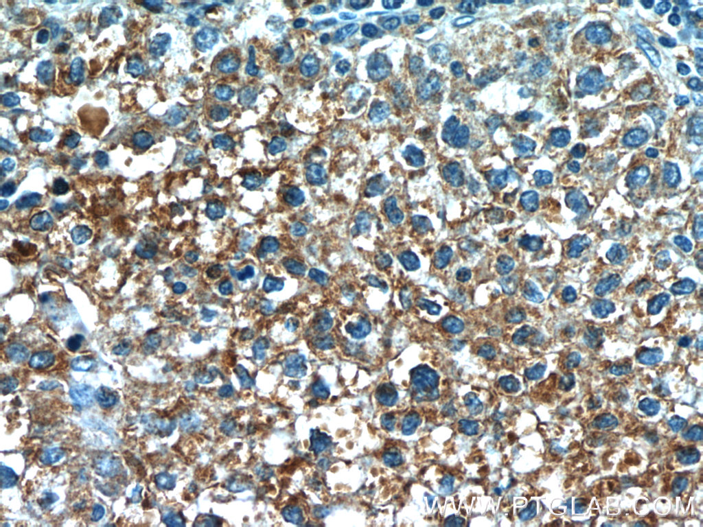 VN1R3 Polyclonal antibody