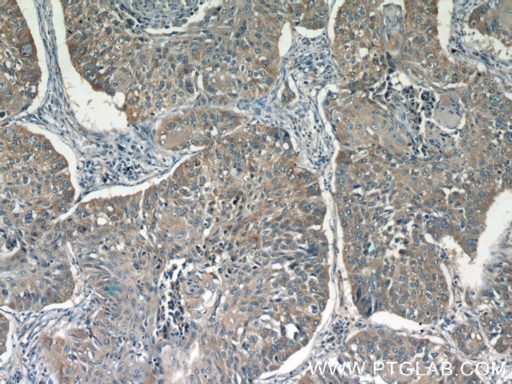 GGT7 Polyclonal antibody