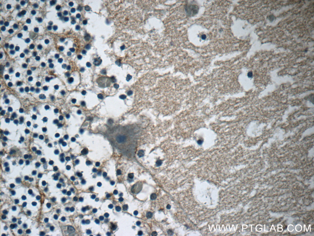 AMMECR1 Polyclonal antibody