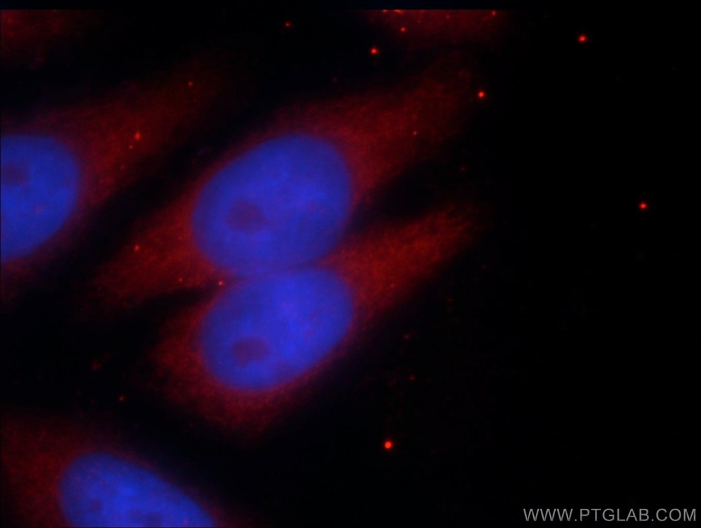 PRY Polyclonal antibody