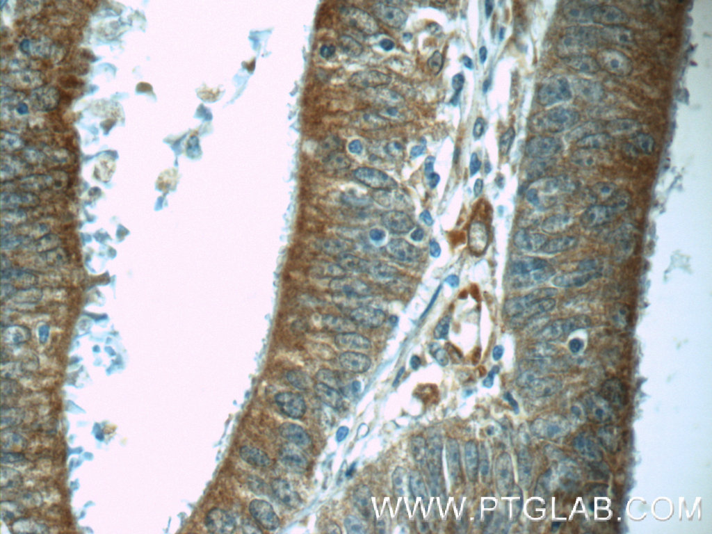 C6orf70 Polyclonal antibody