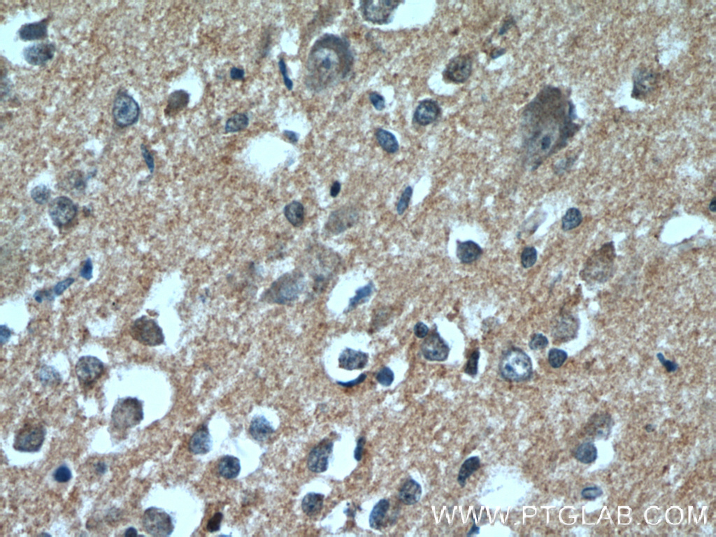 DAOA Polyclonal antibody
