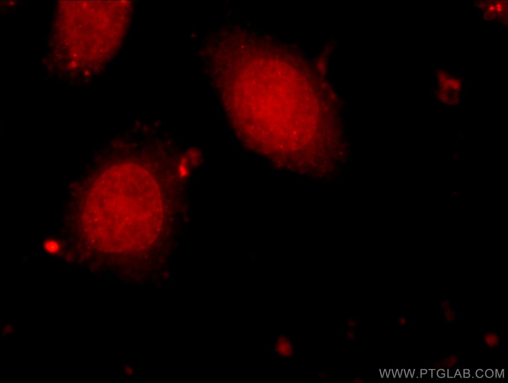 HELB Polyclonal antibody