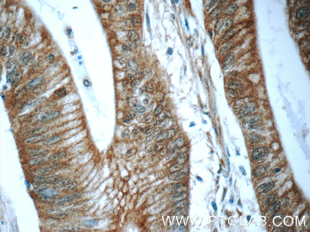 BEND4 Polyclonal antibody