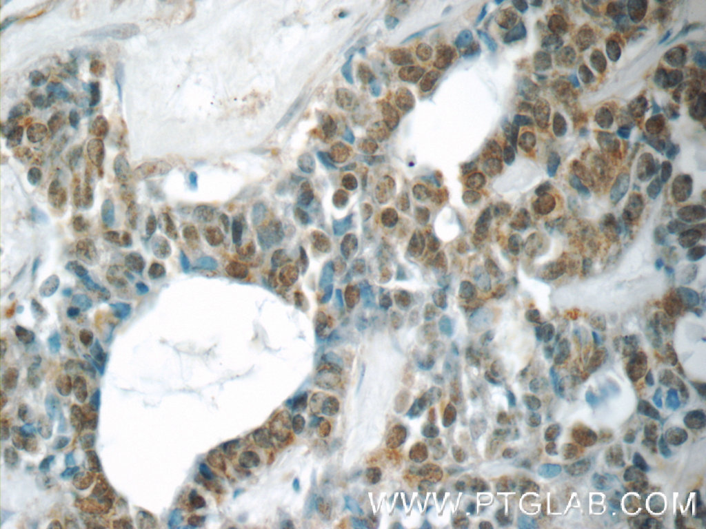 YEATS2 Polyclonal antibody
