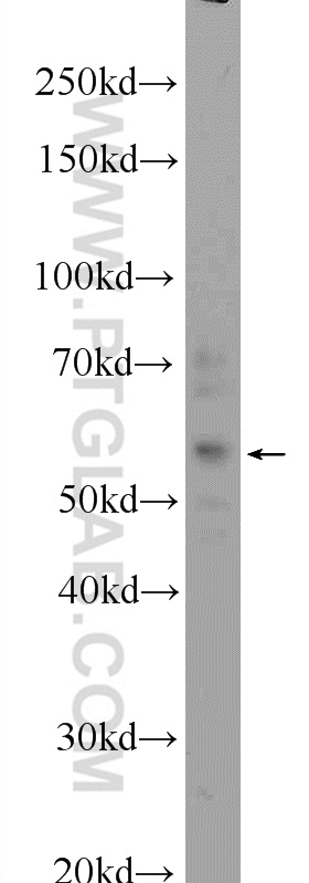 ZFP2 Polyclonal antibody
