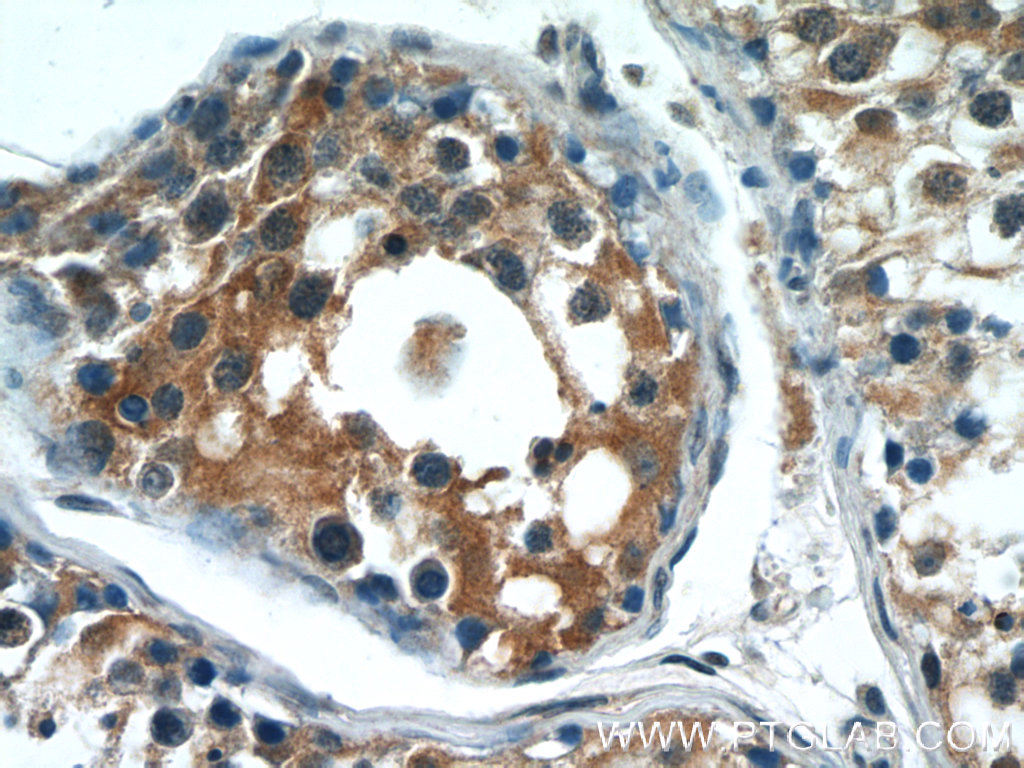 C14orf138 Polyclonal antibody